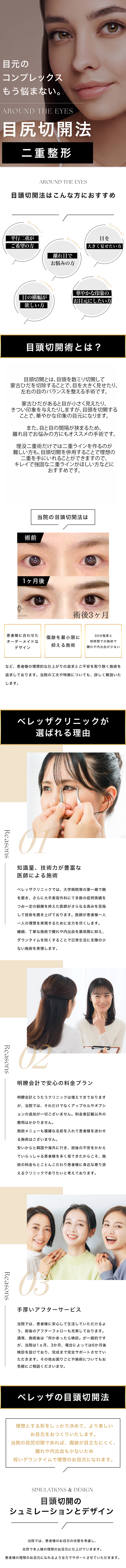 ベレッザクリニックでの目頭切開の施術について