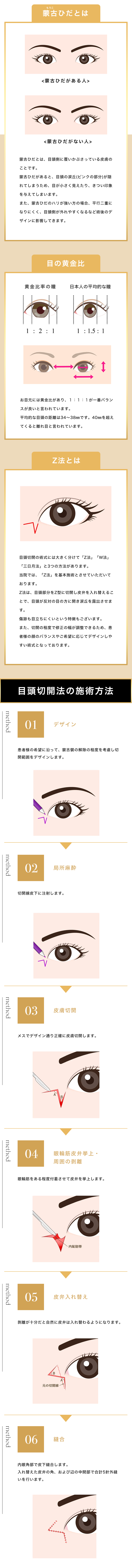 目頭切開の手術方法
