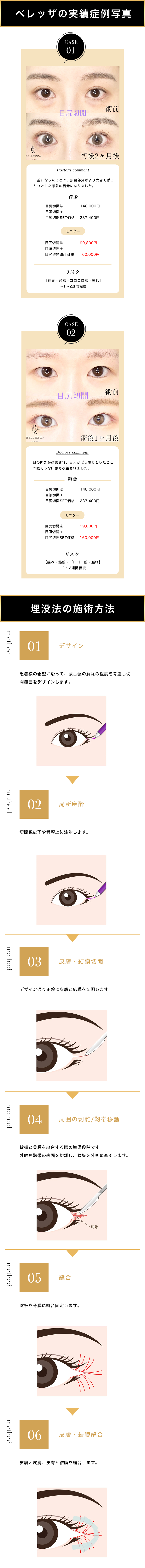 ベレッザクリニックでの目尻切開の手術方法