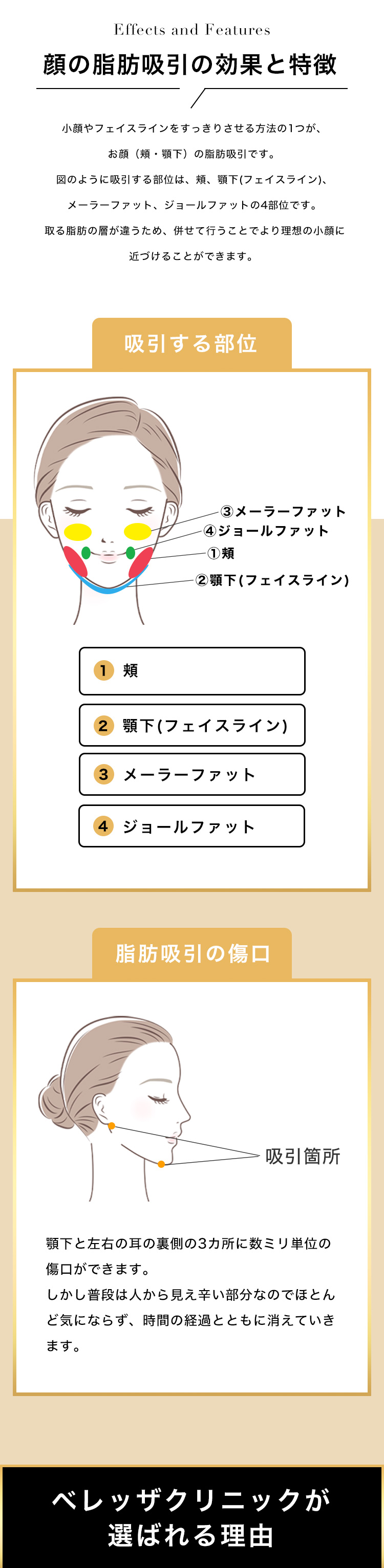 脂肪吸引で吸引する部位